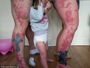 Làm mẹ - Chuyện cha mẹ xăm hình giống vết bớt của con gây xúc động
