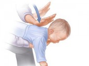 Làm mẹ - Cẩm nang sơ cứu trẻ bố mẹ CẦN biết