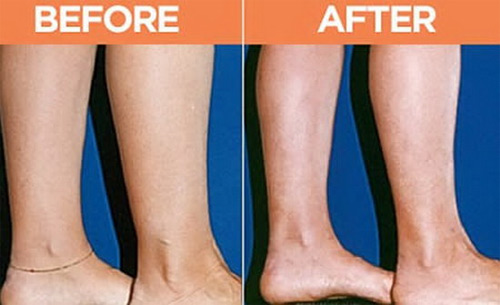 Những ca phẫu thuật thẩm mỹ siêu kỳ quái - 4