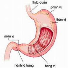 Hẹp môn vị - biểu hiện của nhiều bệnh nguy hiểm - 1