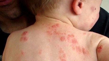 Dị ứng trẻ: Gác cổng làm khổ chủ nhà - 1