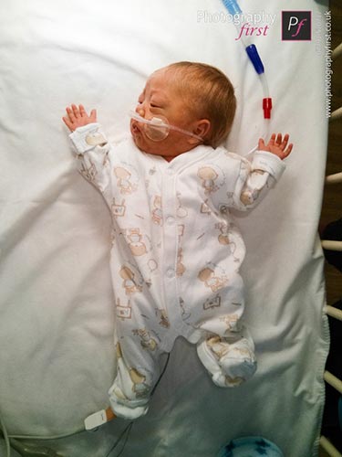 hanh trinh phi thuong cua em be 0,7kg - 12