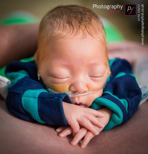 hanh trinh phi thuong cua em be 0,7kg - 11
