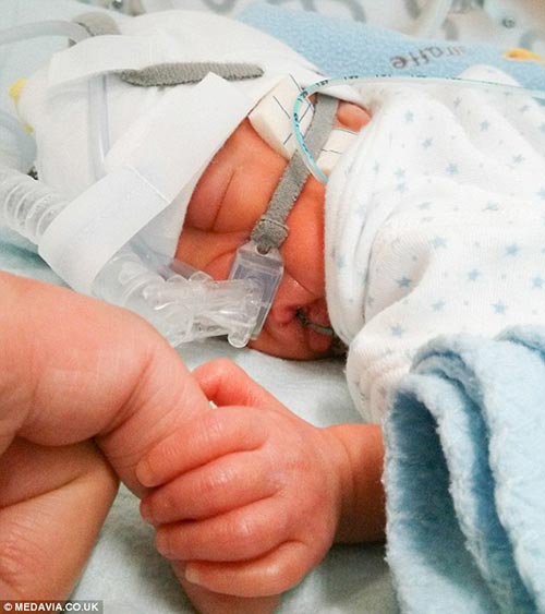 hanh trinh phi thuong cua em be 0,7kg - 5