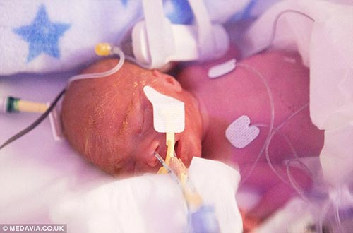 hanh trinh phi thuong cua em be 0,7kg - 1