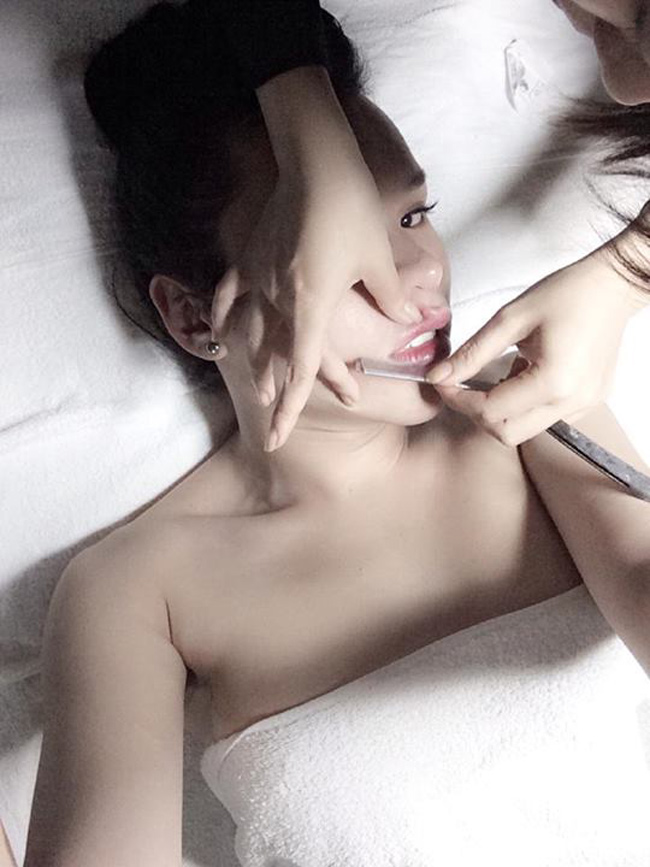 ' Bản sao Hà Hồ ' đăng ảnh chuyển giới đau đớn
