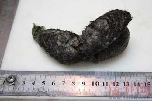 nhung benh nhi suyt tu vong vi 'an toc' - 2