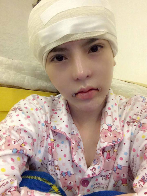 nhung co gai manh dan cong khai phau thuat tham my - 10