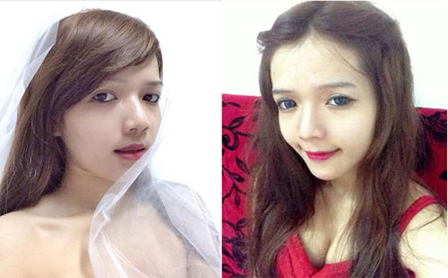 nhung co gai manh dan cong khai phau thuat tham my - 8