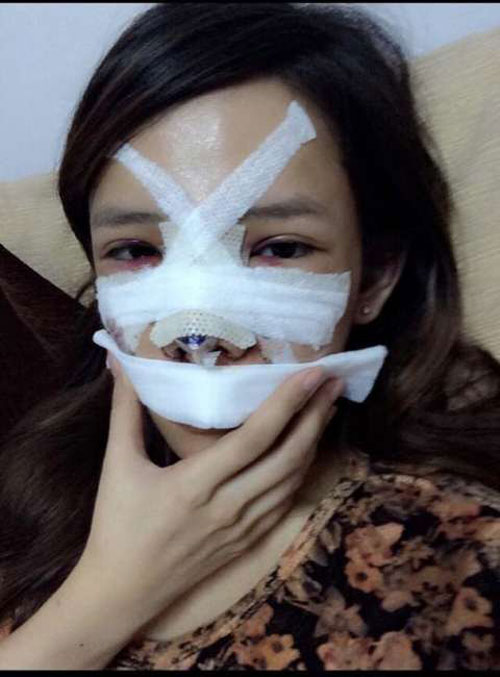 nhung co gai manh dan cong khai phau thuat tham my - 7