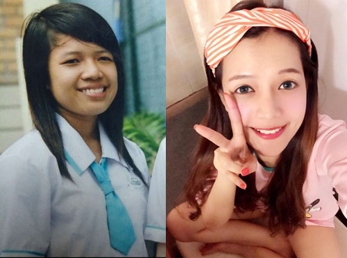 nhung co gai manh dan cong khai phau thuat tham my - 6