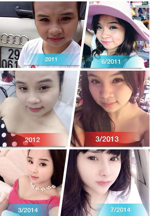 nhung co gai manh dan cong khai phau thuat tham my - 4