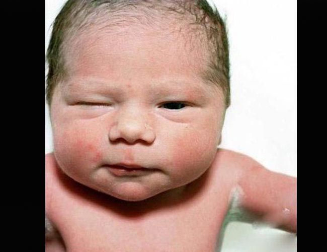 Trẻ sơ sinh mới chào đời: ' sốc ' vì quá xấu