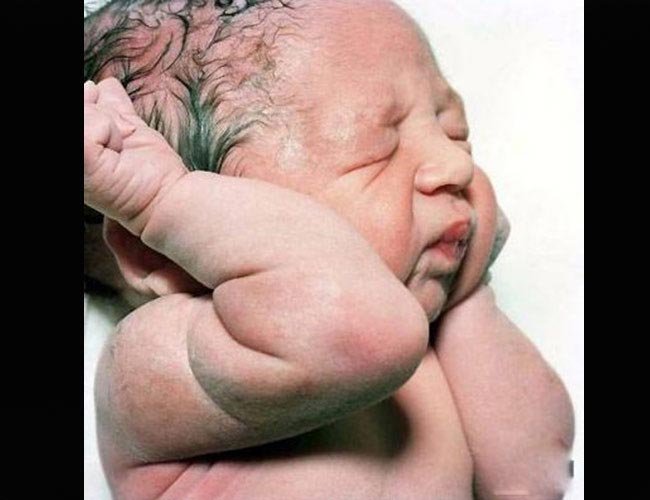 Trẻ sơ sinh mới chào đời: ' sốc ' vì quá xấu