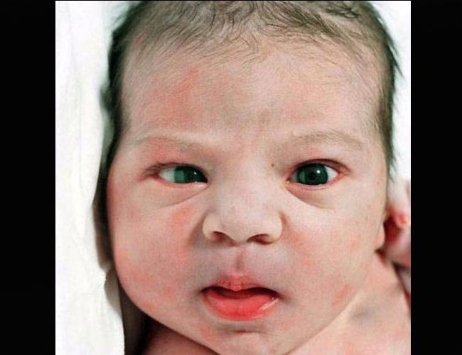 Trẻ sơ sinh mới chào đời: ' sốc ' vì quá xấu