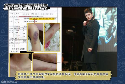 my nhan han dep nhat the gioi bi to ga gam ceo - 6