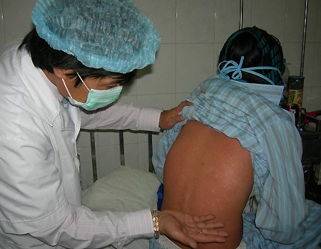 xuat hien o dich rubella tai binh duong: 138 ca nghi nhiem - 1