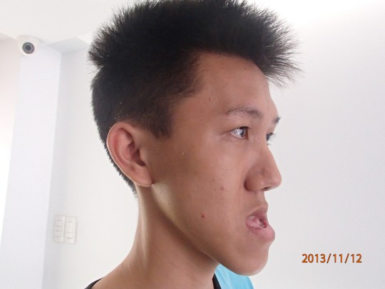 cat ham cuu thanh nien hon 6 nam khong ngam mieng duoc - 1