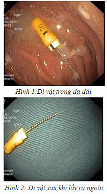 be trai 4 tuoi nguy kich vi nuot phai kim - 1