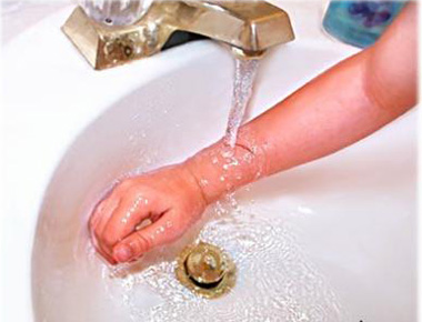 Xử lý vết thương nhẹ chảy máu - 2