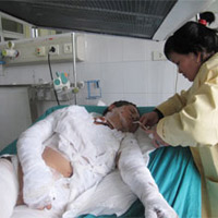 Nỗi lòng người bị chồng tẩm xăng