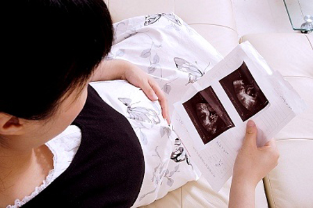 Dấu hiệu sớm của thai ngoài tử cung - 2
