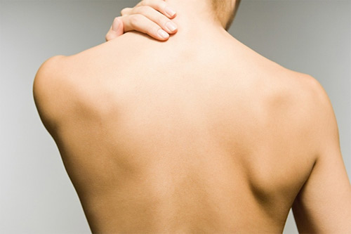 Trị mụn trứng cá ở lưng - 1