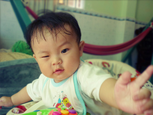 Bệnh nháy mắt nhiều ở trẻ em - 1
