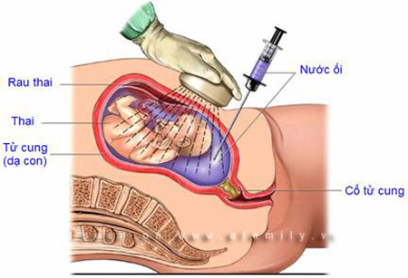 Nhật ký bà mẹ mang thai dị tật (P.3) - 1