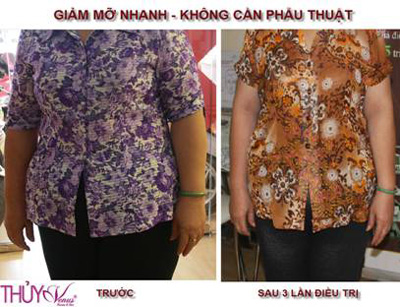 Giải pháp giúp lấy lại vóc dáng thon thả - 1