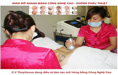 Giải pháp giúp lấy lại vóc dáng thon thả - 3