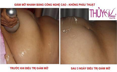 Giải pháp giúp lấy lại vóc dáng thon thả - 6