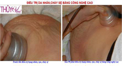 Giải pháp giúp lấy lại vóc dáng thon thả - 7