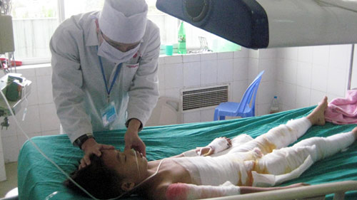 Thuốc nam chữa bỏng: Nhiều trẻ tử vong, tai biến nặng - 1