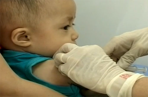 benh soi lan rong tai tp.hcm - 3