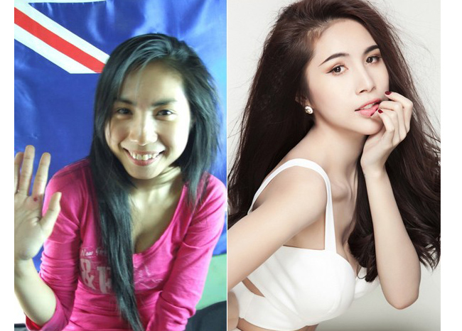 Sao Việt nào xấu đi vì nâng mũi?