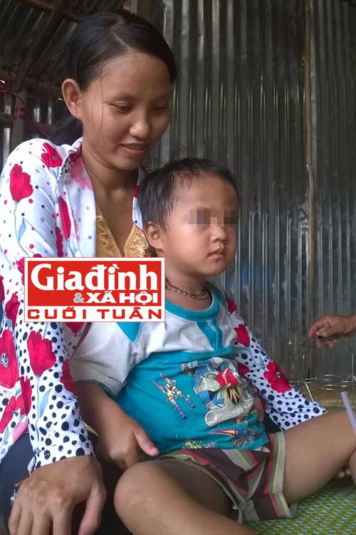 cha me dau kho truoc tin don sinh con co 2 'cua quy' - 2