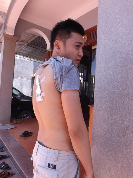 bi nguoi yeu cu bat coc, nu sinh vang thi 2 mon cuoi - 1