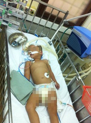be trai hon 2 tuoi chan thuong so nao do nga cau thang - 1