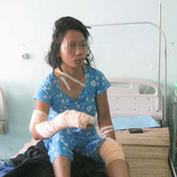Không biết 'ân ái', bị chồng đánh đập dã man