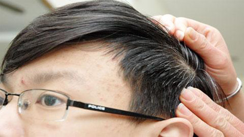 Món ăn - bài thuốc chữa chứng tóc bạc sớm - 1