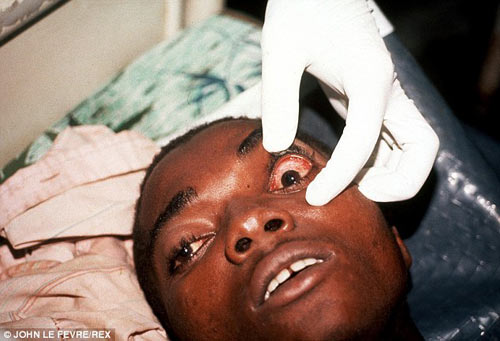 noi am anh khung khiep cua bac sy o tam dich ebola - 2