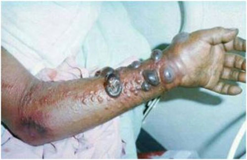 ai co nguy co nhiem virus ebola? - 2