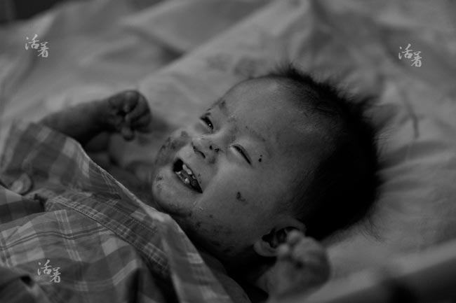Xót xa em bé da bóng nước bị người thân bỏ rơi