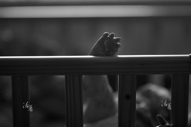 Xót xa em bé da bóng nước bị người thân bỏ rơi