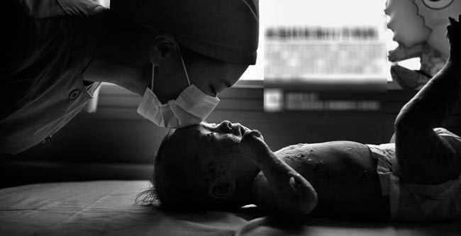 Xót xa em bé da bóng nước bị người thân bỏ rơi