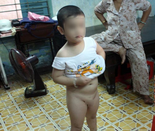 cau be bi gi khoan vao vung kin: tro dua quai ac - 2
