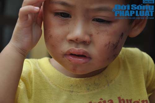 nguoi dan ba doc ac mieu ta cach bao hanh chau be 2 tuoi - 1