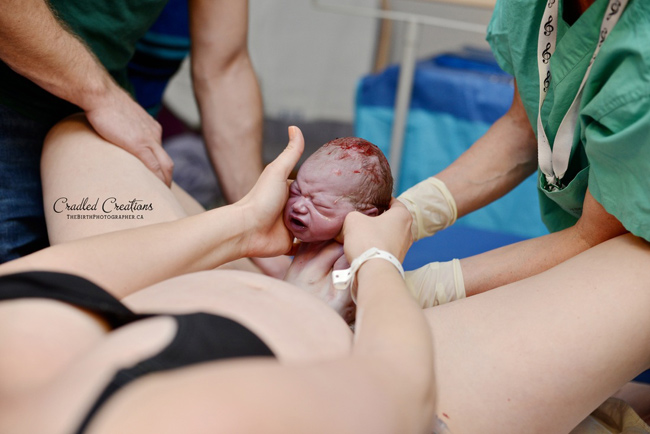 Những hình ảnh chân thực đến dữ dội khi bé lọt lòng mẹ