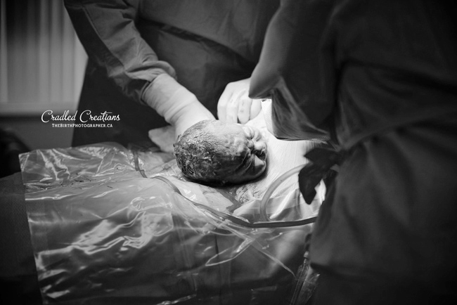 Những hình ảnh chân thực đến dữ dội khi bé lọt lòng mẹ